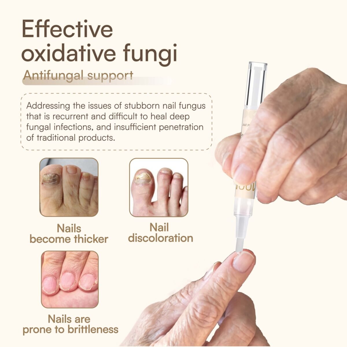 Natural Antifungal Pen - Immagine 3