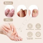 Natural Antifungal Pen - Immagine 5