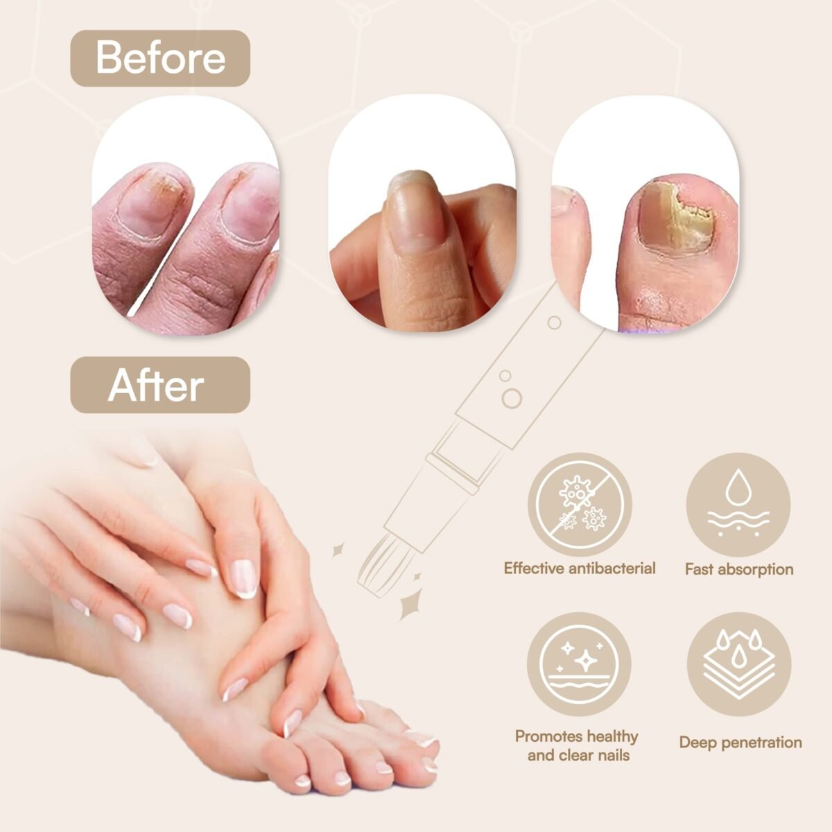 Natural Antifungal Pen - Immagine 5